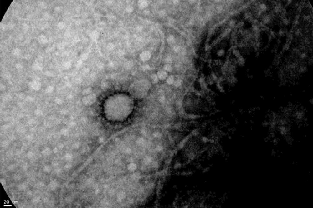 Foto del Coronavirus